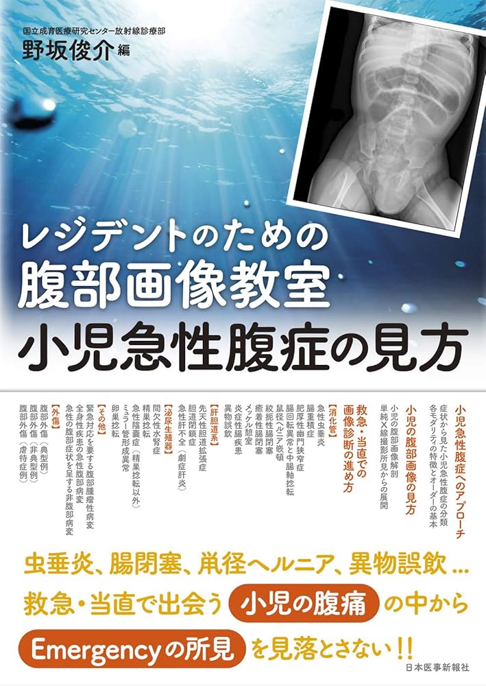 レジデントのための腹部画像教室【小児急性腹症の見方】 | 野坂
